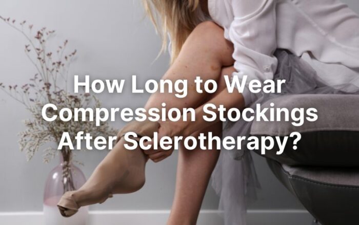 How Long Does Spider Vein Treatment Last?