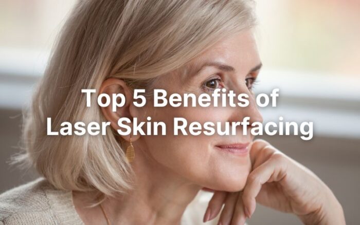 Top 5 Benefits of Laser Skin Resurfacing